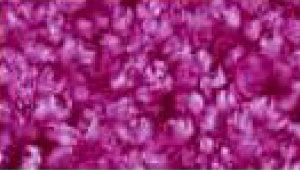 carpet runner pink